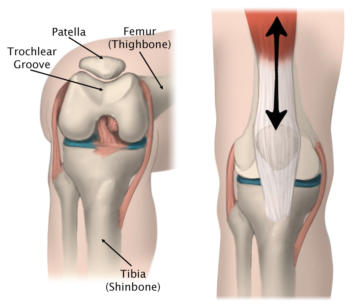 Lateral Patellar Compression Syndrome Treatment in Pune