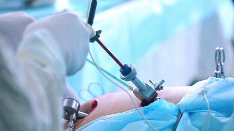 Arthroscopy Treatment vs. Traditional Surgery: Which is Better?